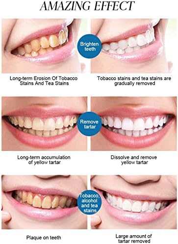 Disaar Beauty Bave de dente natural O reparo sensível fortalece o esmalte de dente reduz a sensibilidade da oxidação