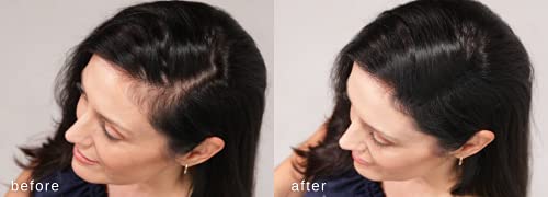 Fibras espessantes de cabelo de luxo - confiança em uma jarra - 2 meses+ suprimento! - Hipoalergênico, dermatologista